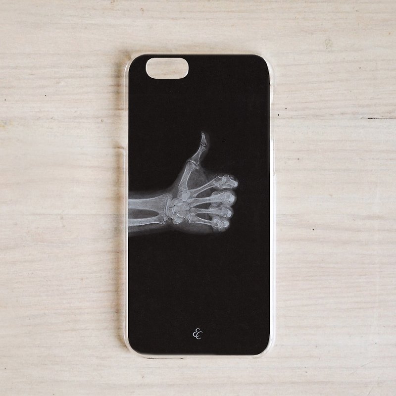 X光定制手机壳-你最棒 多型号 解剖学医师护理师放射师礼物 赞 - 手机壳/手机套 - 塑料 
